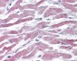 AKT3 Antibody (Internal)